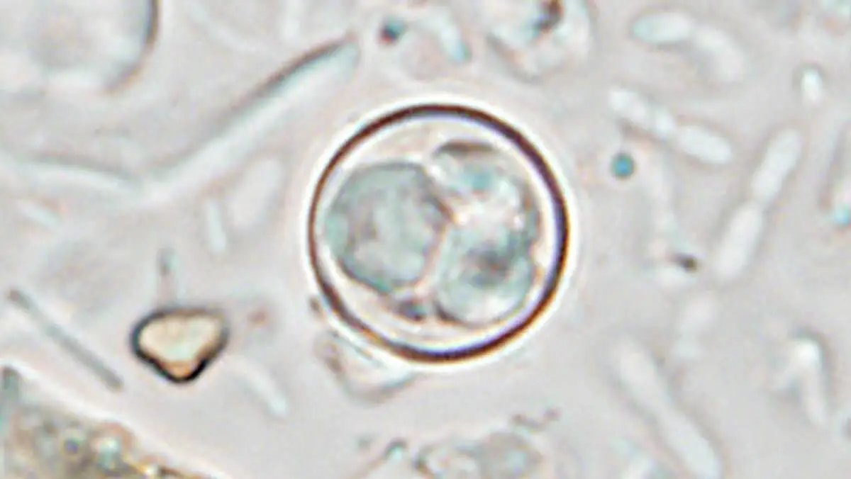 Cyclosporose aux États-Unis Cyclosporose aux États-Unis